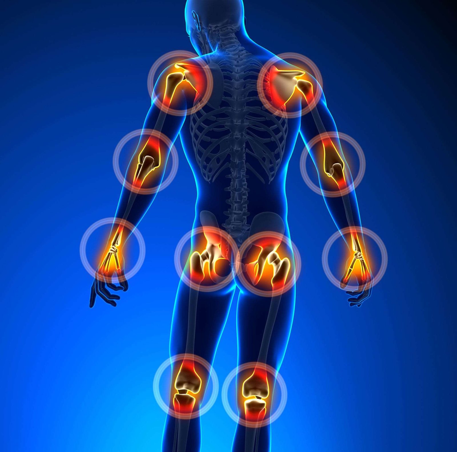 jointPain