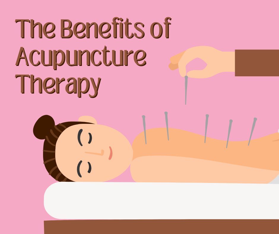 AcupunctureTherapy
